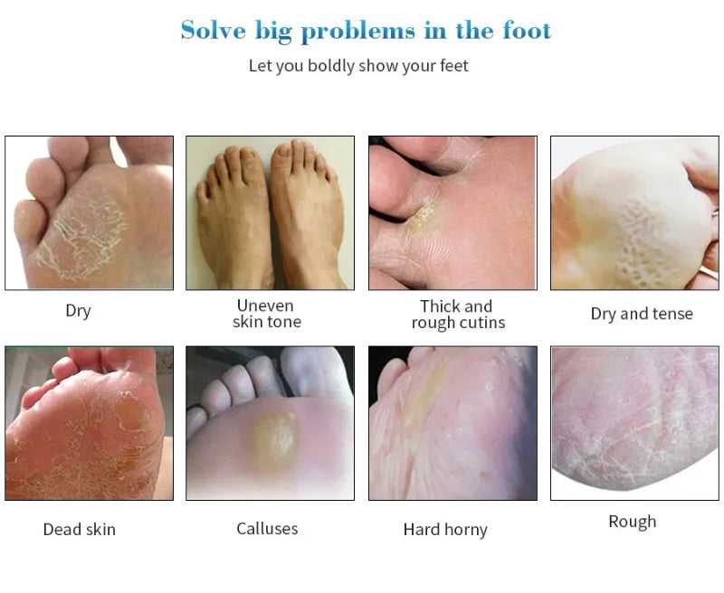 Exfoliating Foot Mask Foot SPA Pedicure Socks Removing Dead Skin Whitening Heels Feet Peeling Anti Cracked Foot Skin Care CJ