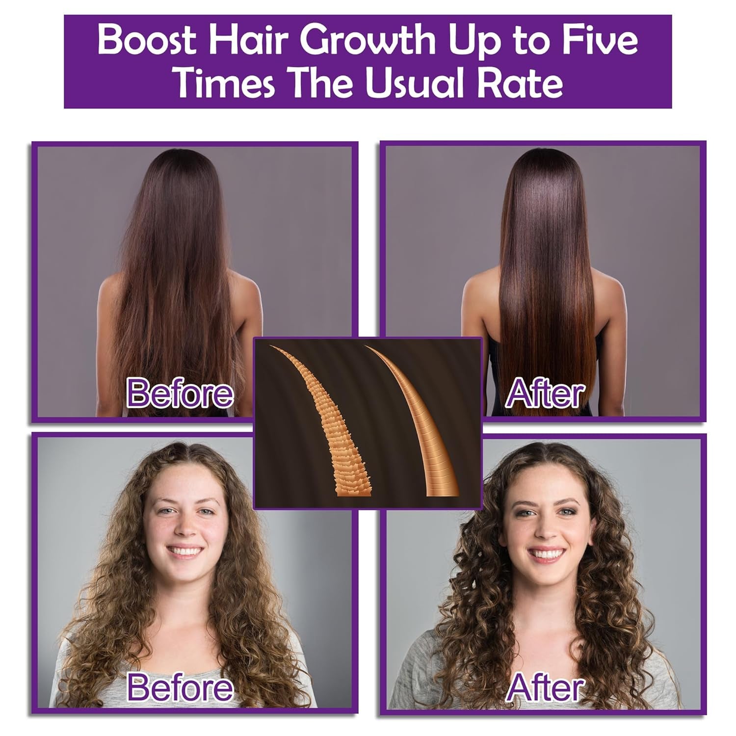 🌿 GIFBEA Hair Growth Shampoo & Conditioner Set with Rosemary Oil Serum – Thicker, Healthier Hair Starts Here